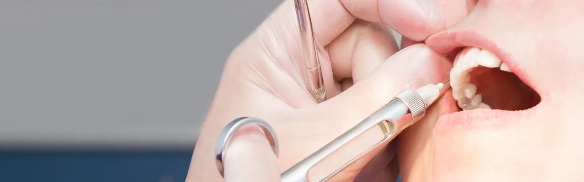 Dental Anesthesia